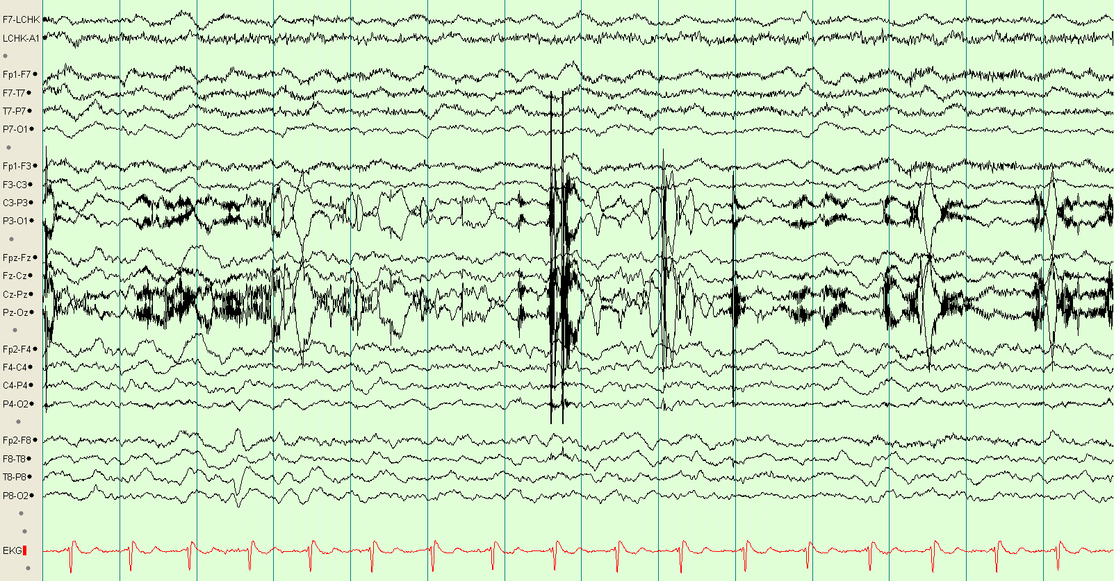Impedance